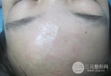 漳州市醫(yī)院整形美容科主任