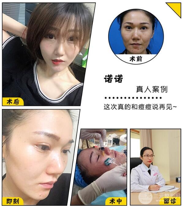 换肤手术有什么危害？科普来啦，揭穿真相！