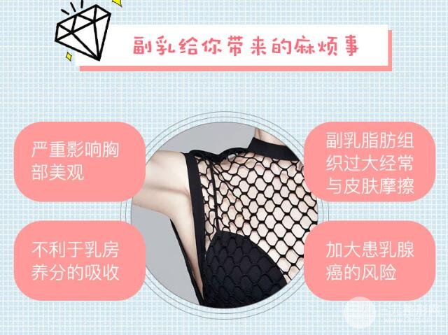 为什么会出现腋下副乳?