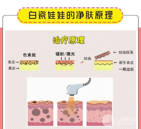 白瓷娃娃是什么?