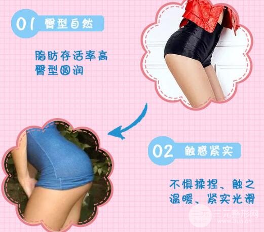 提臀术好不好?教你拥有性感美臀~