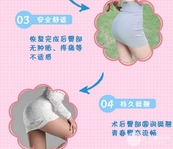 提臀术好不好?教你拥有性感美臀~
