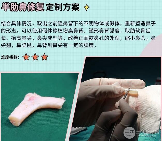 注射隆鼻的修复