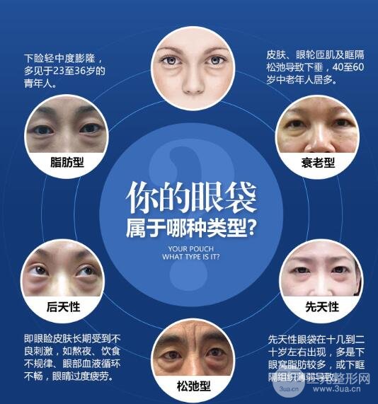 设备的不同