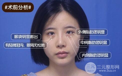 口碑与实力的选择