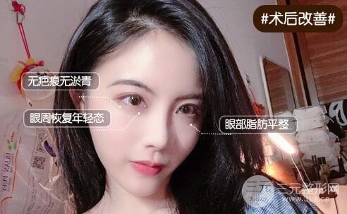 口碑与实力的选择