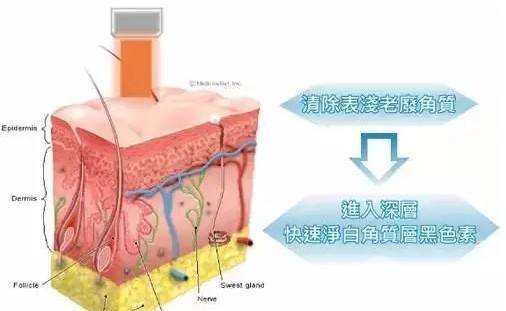 【变白黑科技】白瓷娃娃美白费用是多少？果怎么样？