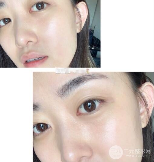 整形案例