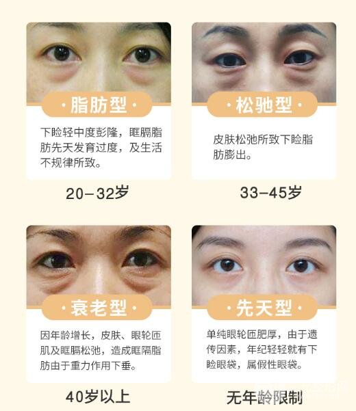眼袋失败修复的原则