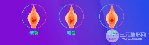 处女膜修复时机