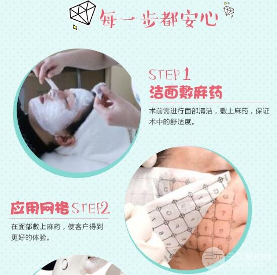热玛吉紧肤除皱有副作用吗？