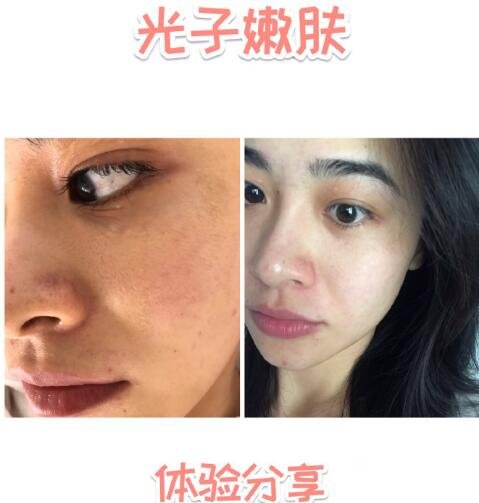 术后注意事项
