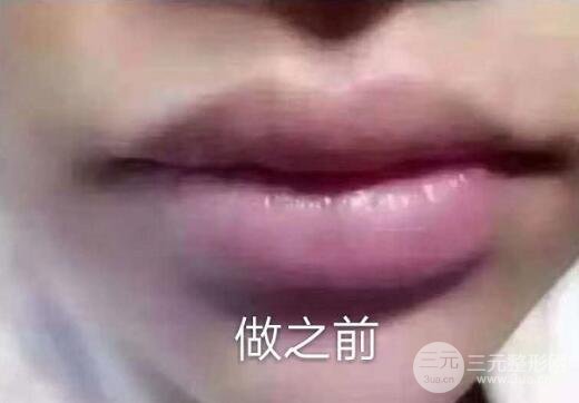 医院的选择?