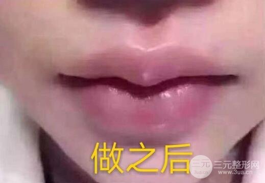 医院的选择?