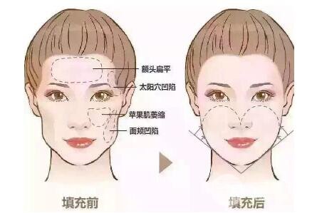 手术之后的注意事项;