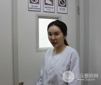 北京协和整形医院隆胸技术如何？看我过来人的经历！