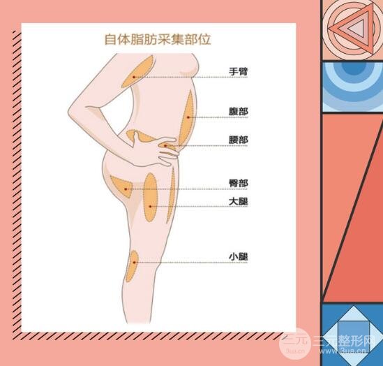 自体脂肪填充面颊降低风险吗?