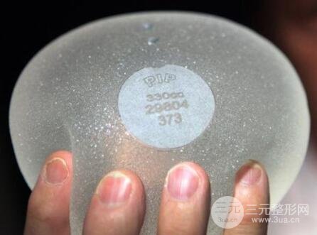 娜绮丽假体隆胸恢复时间?