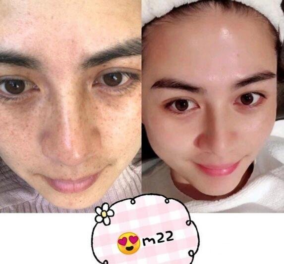 像素激光果图对比