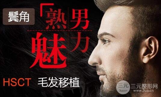 鬓角种植头发所有人都适用吗?