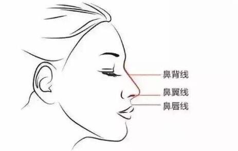 人工骨粉隆鼻注意事项?