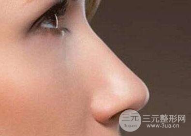 人工骨粉隆鼻到四大危害?