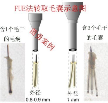 植发算皮肤科还是外科