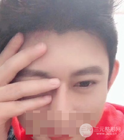 植发价格表