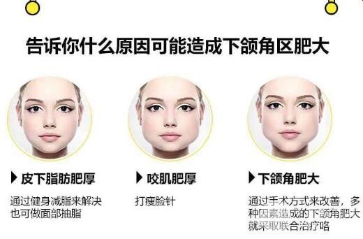关于咬肌注射有什么温馨提示呢?
