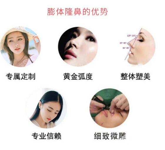 膨体隆鼻优点介绍