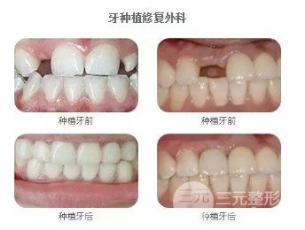 晋中市第一人民医院口腔科价格表