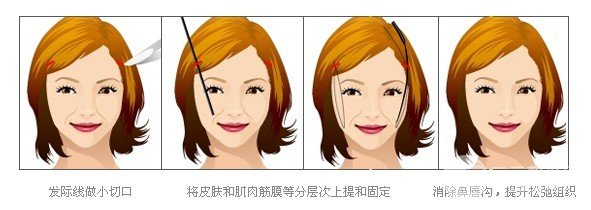[专业解答]微创面部除皱术痛苦吗？术后如何护理？