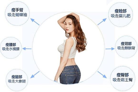 吸脂手术简介