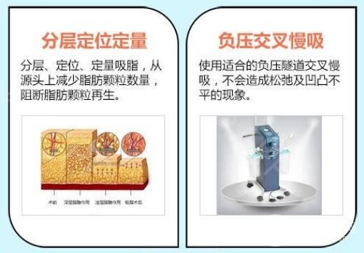 手臂和背部吸脂手术果明X吗？能GET什么样的果？