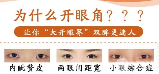 开外眼角优点