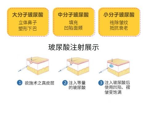 玻尿酸的功能