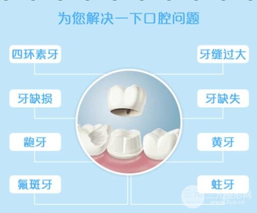 烤瓷牙适用人群