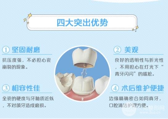 做完烤瓷牙的注意事项