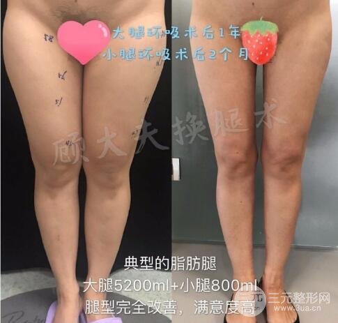 如何避免风险和副作用