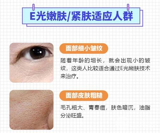 e光嫩肤适应症