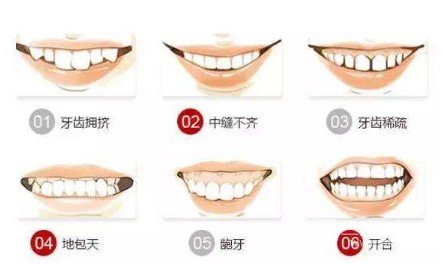 医院可以粘托槽吗