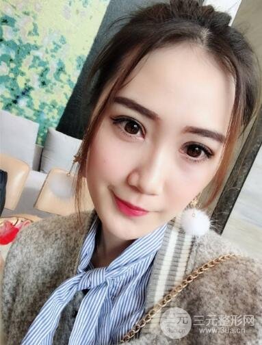 韩式翘睫双眼皮的优点
