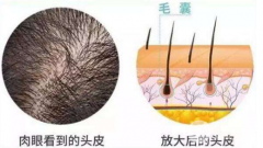 种植头发的价格：康康到底需要多少RMB！