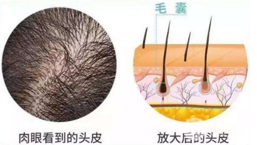 种植头发的价格