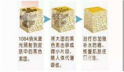 黑脸娃娃多少钱一次