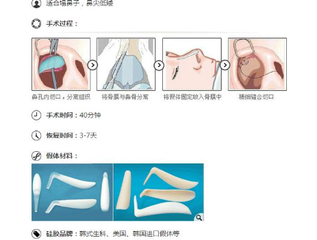 硅胶隆鼻成好吗
