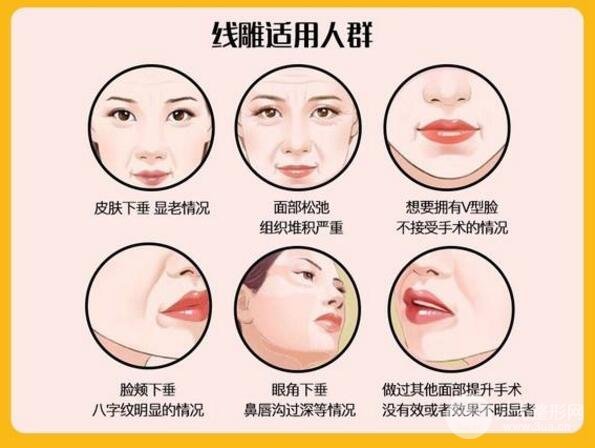 微创面部除皱的价格