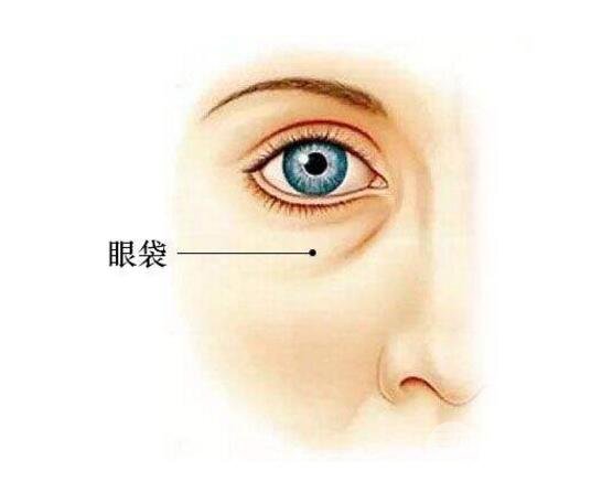 聚能美雕去眼袋多少钱