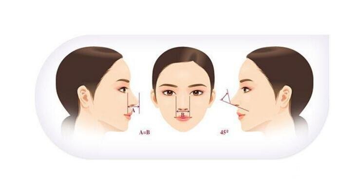 要问我修复鼻子多少钱 这篇文章就来告诉你答案