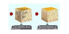 激光去黑眼圈多少钱？靓丽大眼睛就靠Ta~